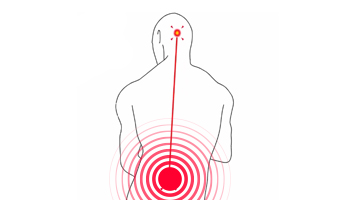 Lower Back Pain